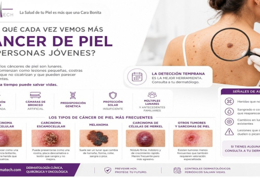Cáncer de Piel en Jóvenes