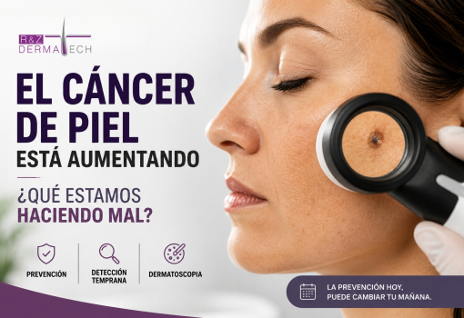 Aumento de Cáncer de Piel
